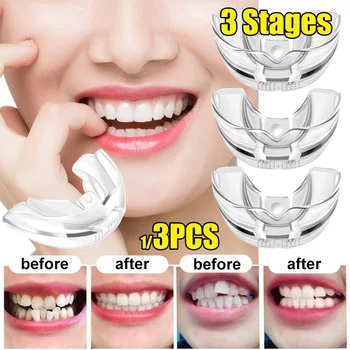 Dantų Straightener3pcs/set Dantų Ortodontinis Treneris Dantų Dantų Prietaisų Derinimas Petnešomis Silikono Medžiaga Profesionalus Darbuotojas